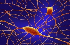 Нейроны Пуркинье (грушевидные клетки)